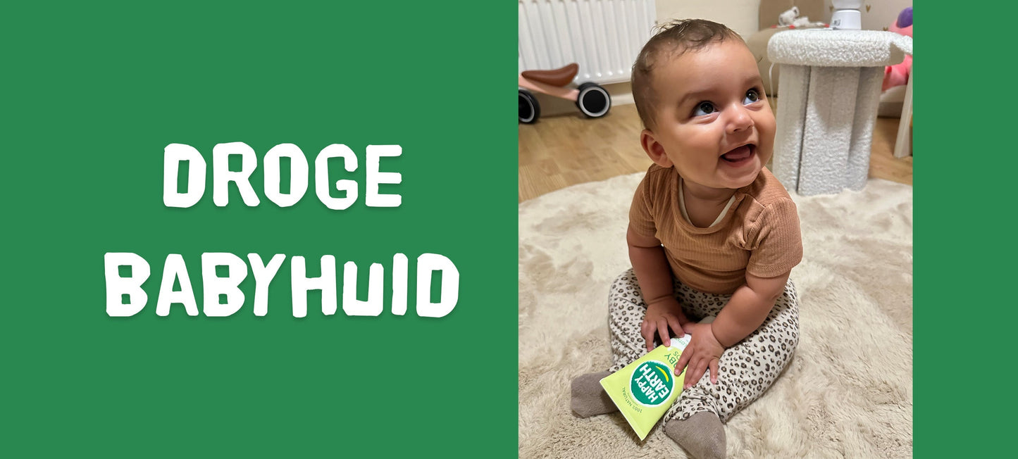 Droge babyhuid? Ontdek natuurlijke tips voor een zachte huid