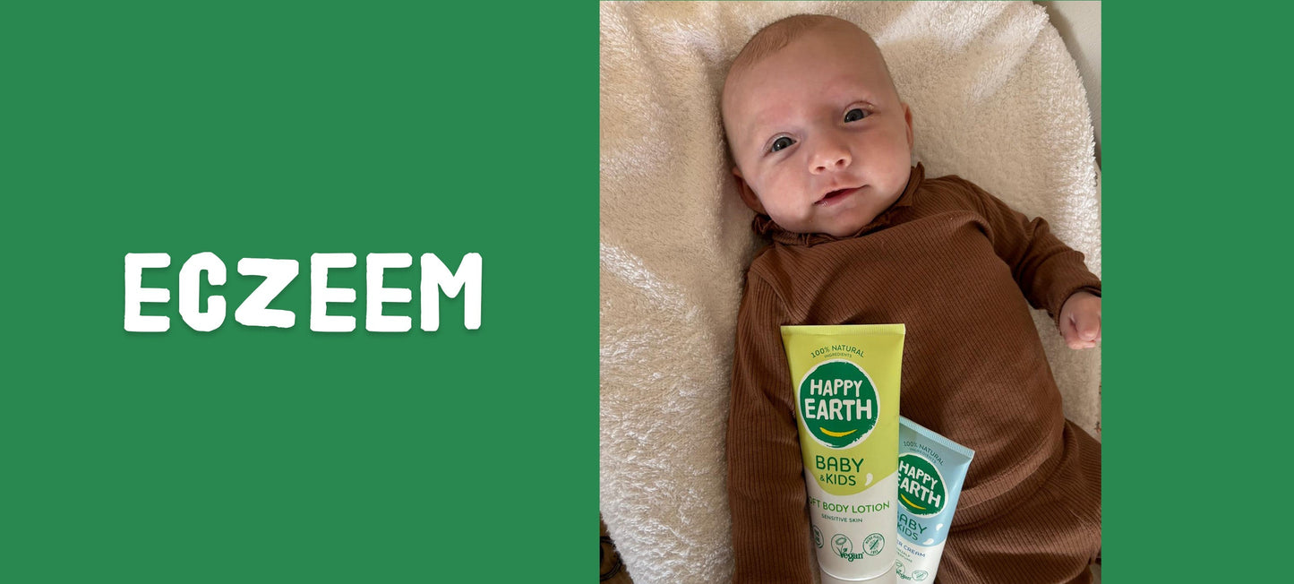 Eczeem bij baby’s? Zo verzorg je de gevoelige huid natuurlijk